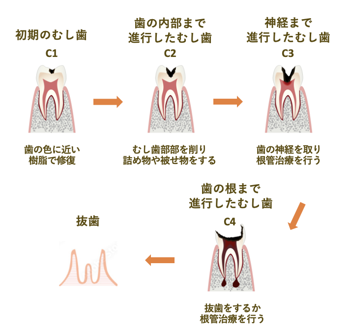 サイクル図