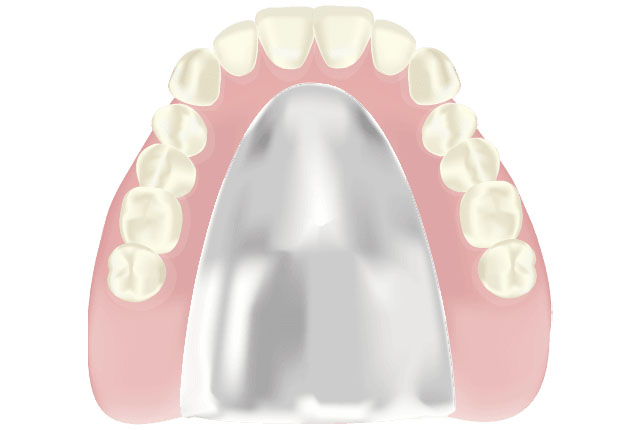 コバルトクロム床義歯
